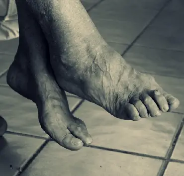 Soy una persona mayor y se me hinchan con frecuencia las piernas y los pies. ¿A qué se puede deber?
